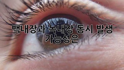 백내장과 녹내장, 동시 발생 가능성은?